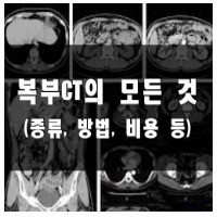 복부CT