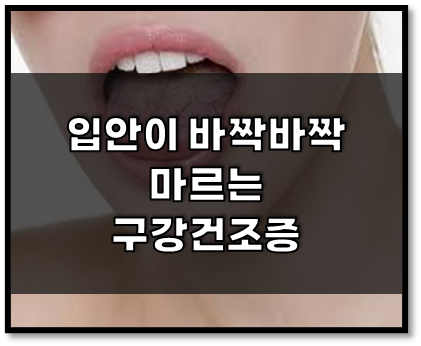 구강건조증의 원인과 증상, 진단과 치료 (사진출처: 헬스경향)