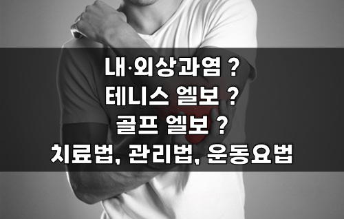 0 내외상과염 썸네일