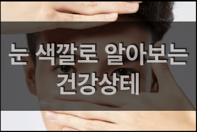 눈 색깔로 알아보는 질병과 건강상태