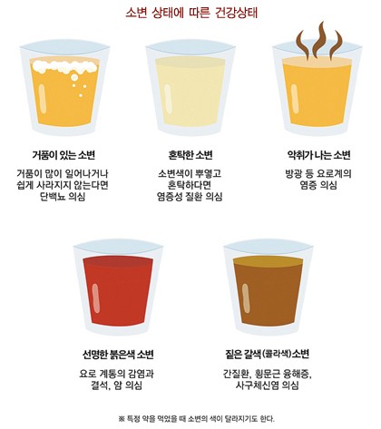 소변색으로 알아보는 질병과 건강상태 색깔별 소변 백세시대색깔별 소변 백세시대