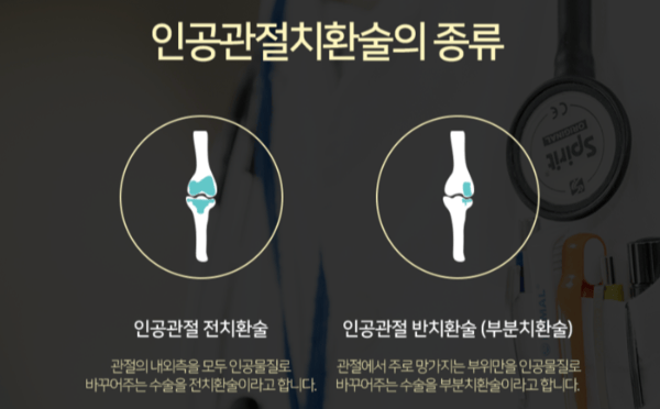 3 인공관절치환술 종류