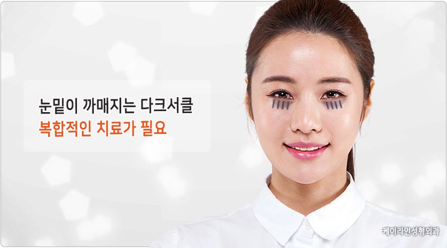 다크서클의 원인과 치료법, 관리법, 다크서클에 좋은 음식 다크서클-min