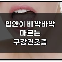 특성_구강건조증-min
