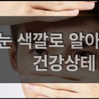 특성_눈색깔로 알아보는 건강상태-min