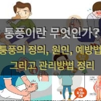 특성_통풍