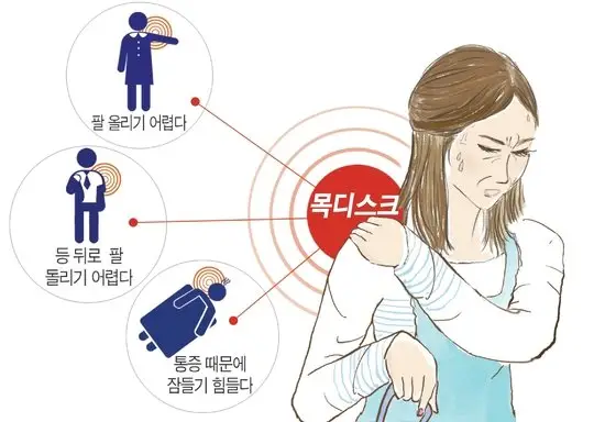 목디스크의 증상 - 중앙일보 (목디스크 자가진단)