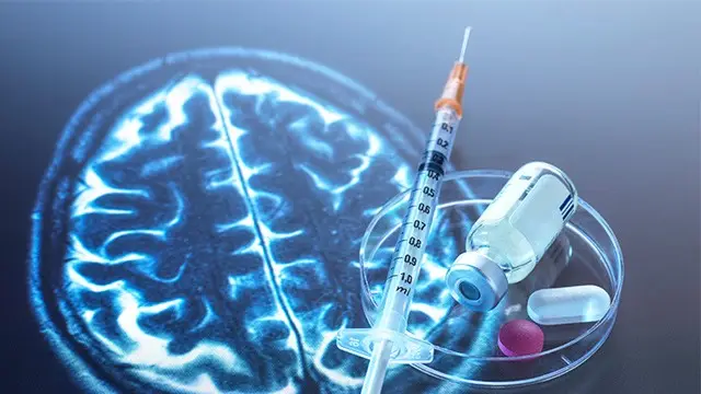 치매 치료제