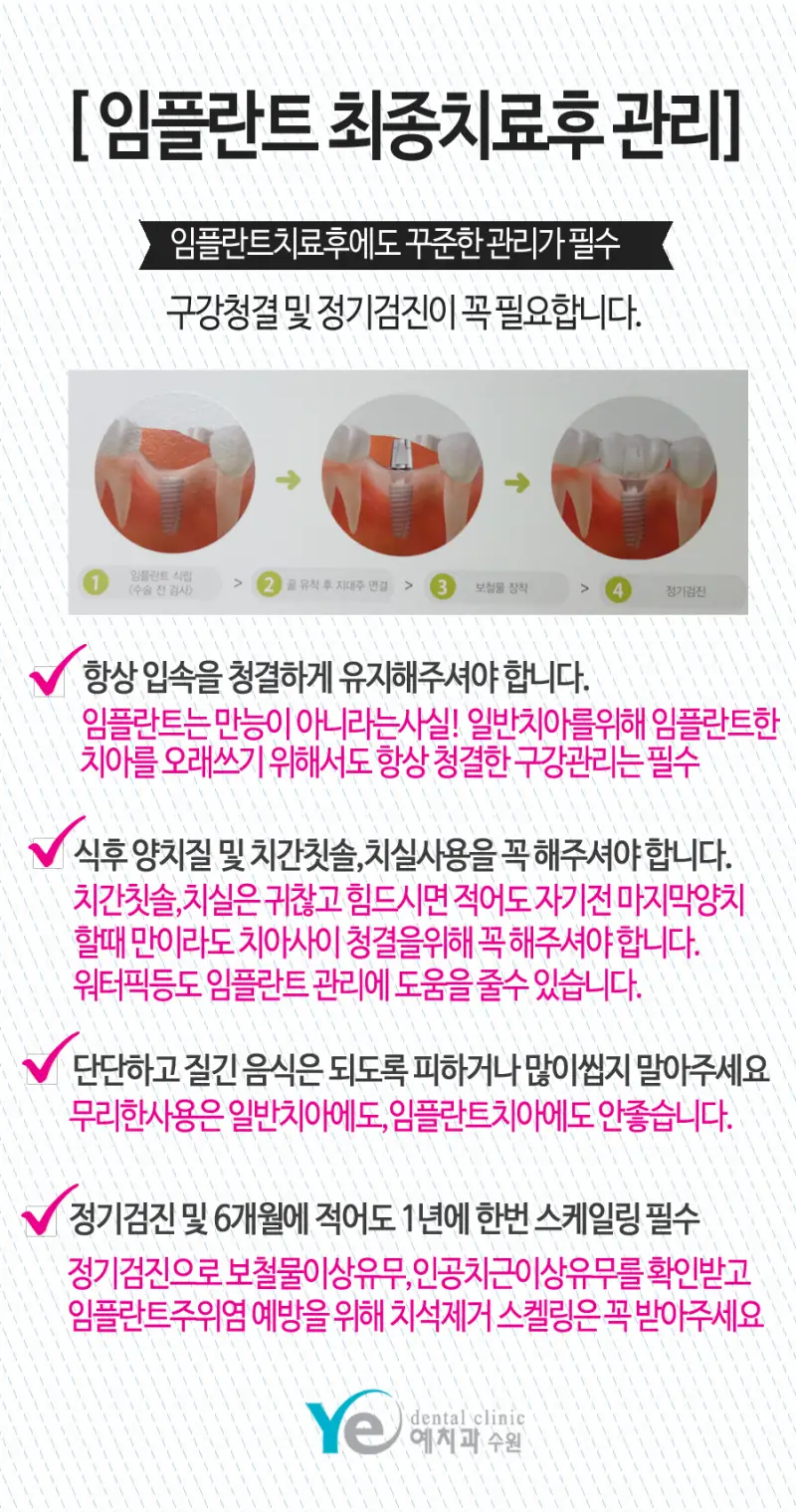 임플란트 수술 후 관리