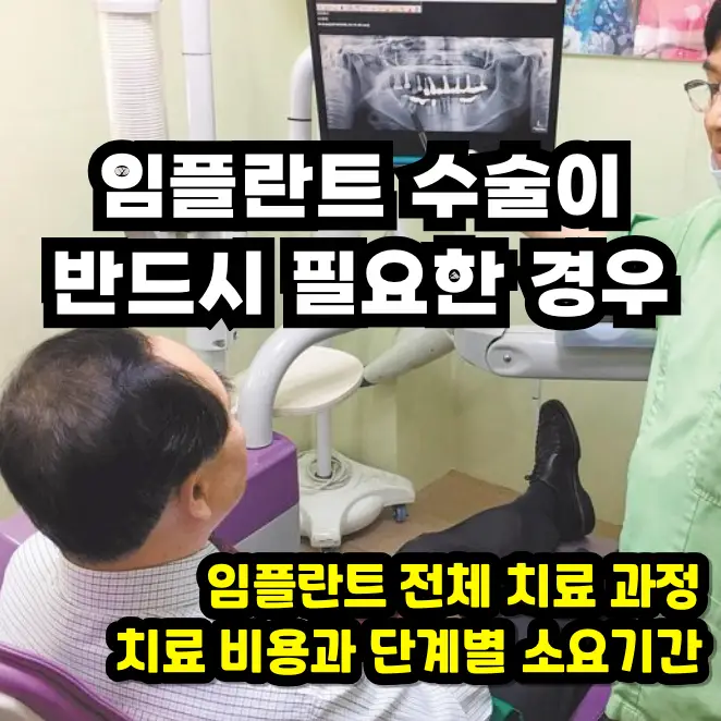 임플란트 수술이 반드시 필요한 경우