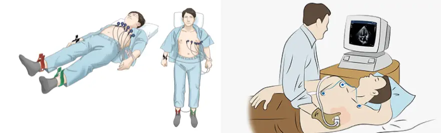 심근경색 진단법 - 심전도검사와 심장초음파