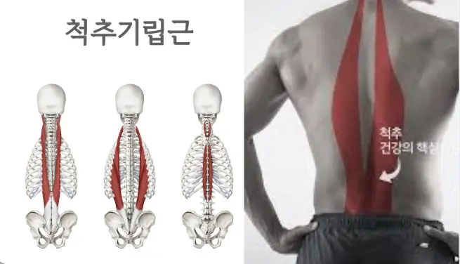 척추기립근